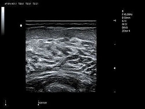 B-режим, 2B / 4B
