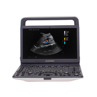 Портативные УЗИ аппараты EVORAY